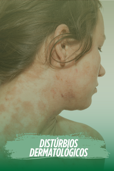 Distúrbios Dermatológicos canabidiol e os beneficios da cannabis medicinal para a saúde Medpics