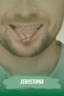 Xerostomia e canabidiol: benefícios da cannabis medicinal para a saúde Medpics